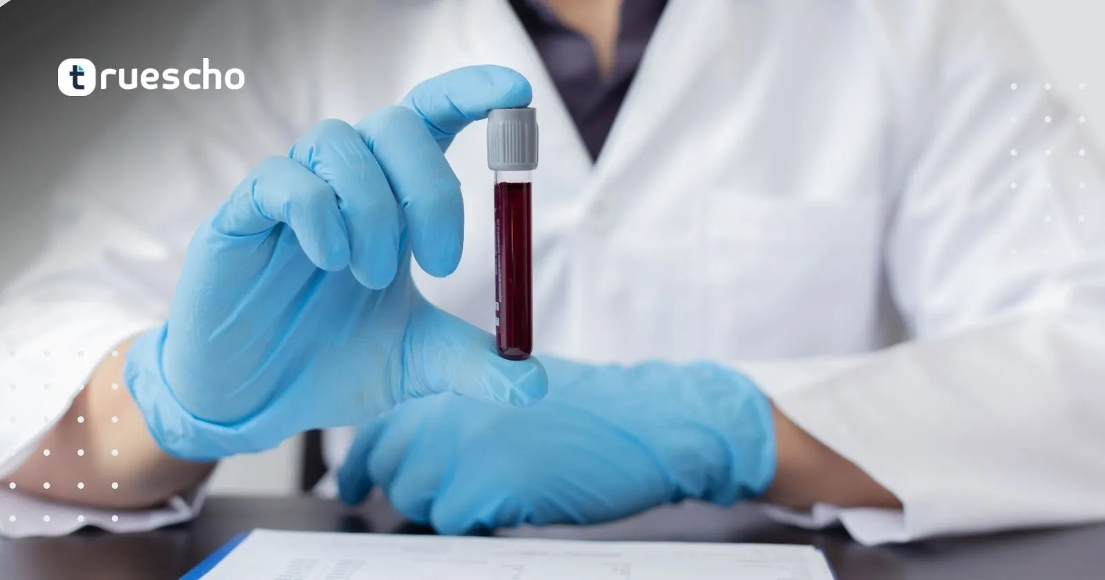 تحاليل الهرمونات النسائية